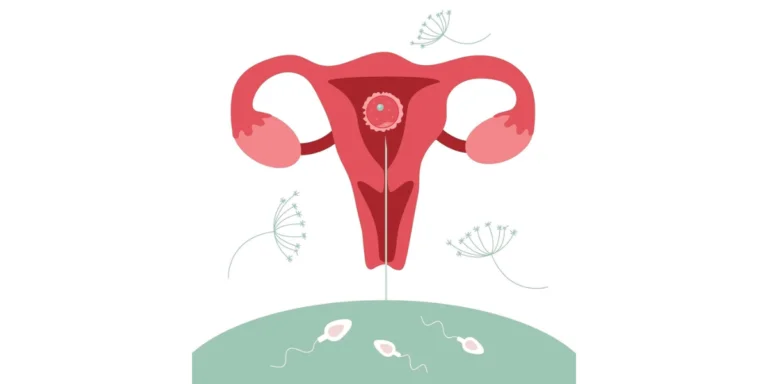 Is IUI Painful? Get the Best IUI Treatment in Delhi with Affordable Options