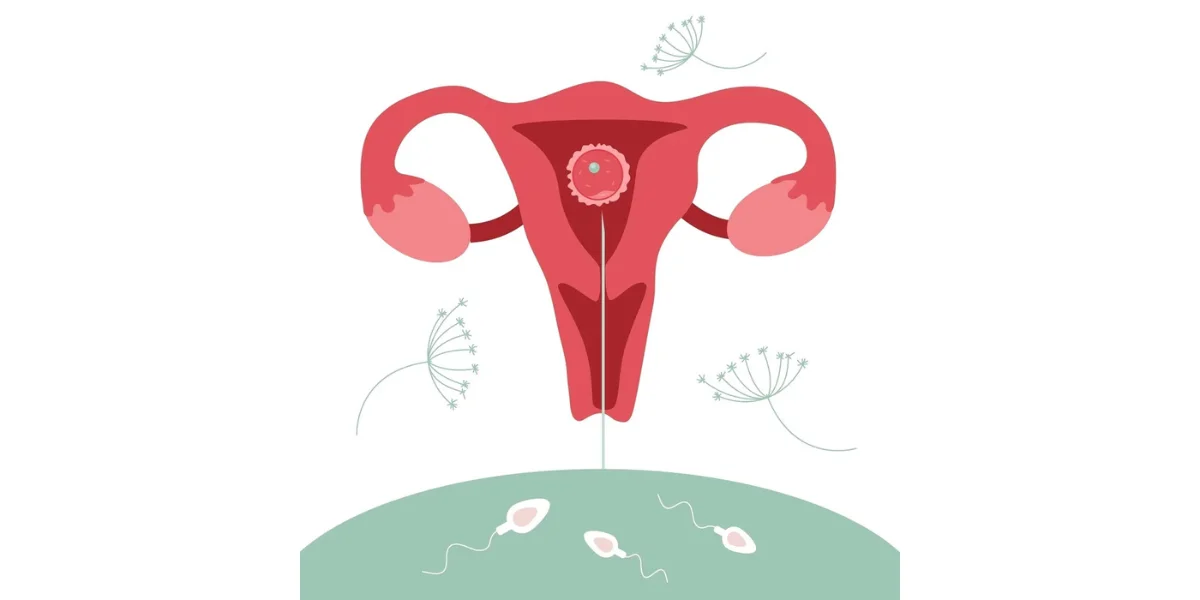 IUI Banner