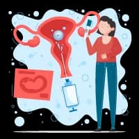 PCOS Treatment