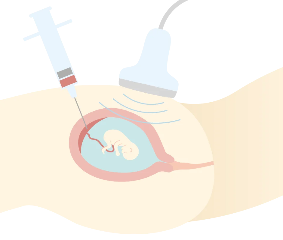 ICSI Illustration