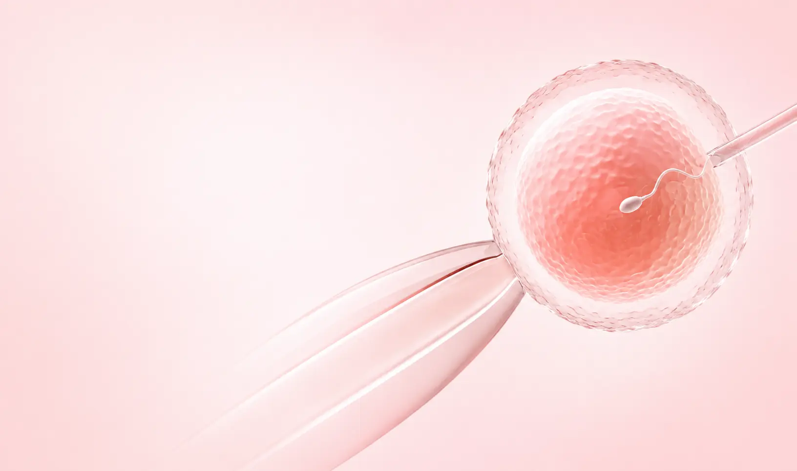 IVF Treatment