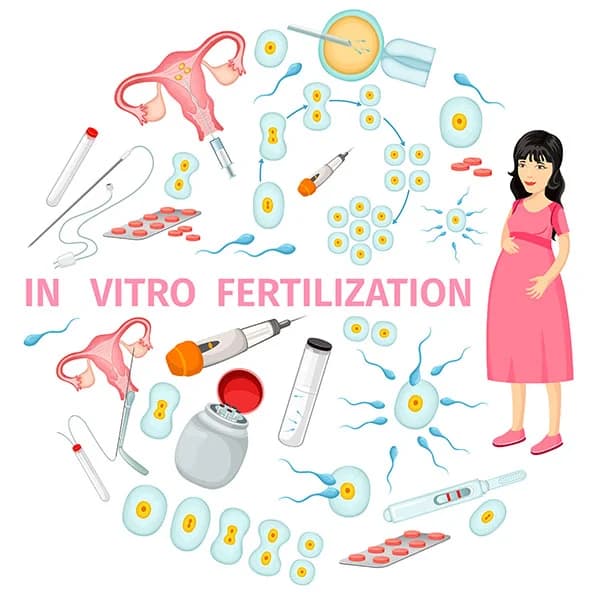 In Vitro Fertilization illustration
