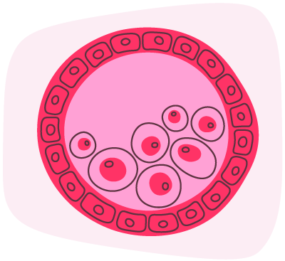 Blastocyst Hatching